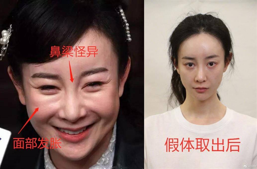 娄艺潇动脸的7位女星，一个比一个神奇，有人请医美专家鉴定自己纯天然