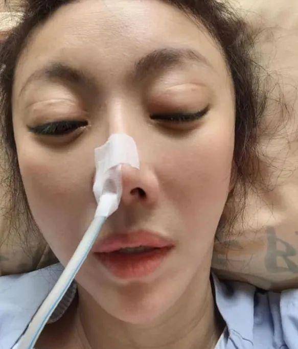偶像|突然肠爆裂病危！49岁著名女星仍未度过危险期，丈夫拒绝放弃救治
