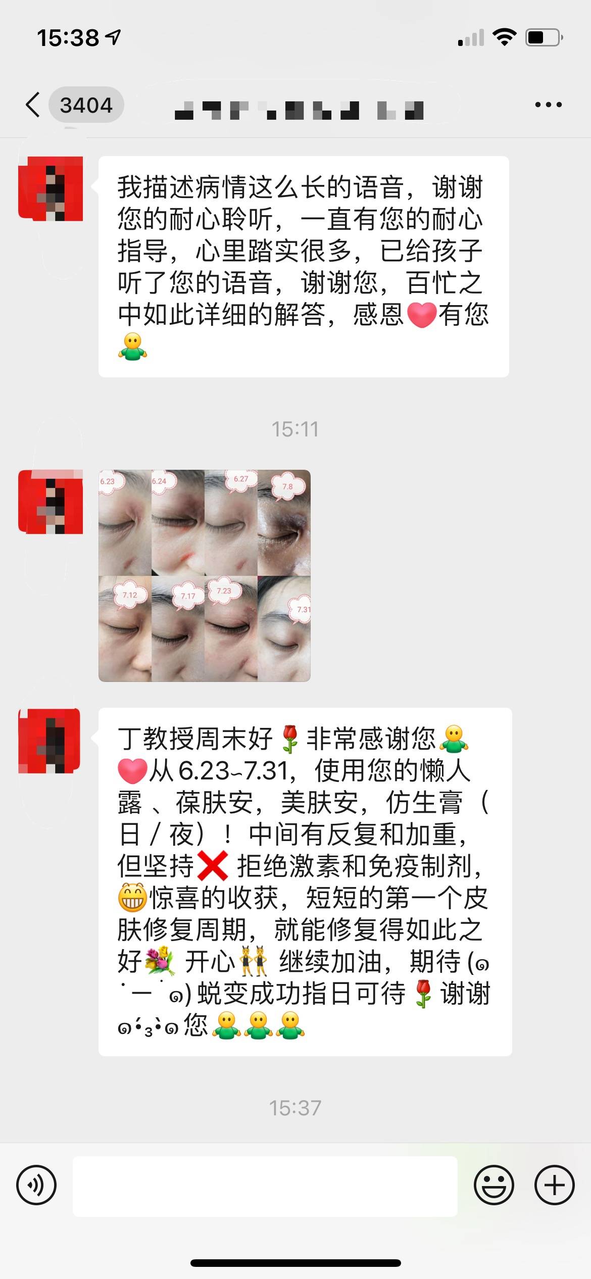 免疫华纳药业：眼部湿疹患者短短一个月的