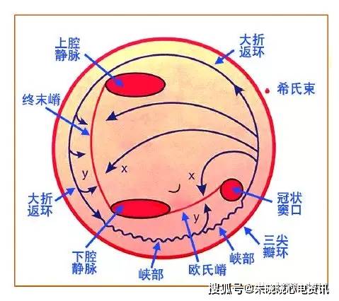 图8 三尖瓣峡部依赖性房扑折返环路的示意图x,y 分别为终末嵴和欧氏嵴