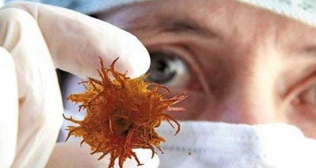 疾病|专家揭秘:患上白血病的原因,了解这3点,白血病“绕着”你走!