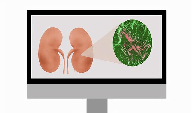 症状|慢性肾衰竭总是“悄无声息”？有哪些早期症状需关注？要学会识别