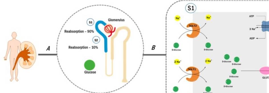 关系|血糖高,与这8个环节有很大关系,找出原因帮你更好的控制血糖