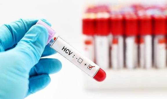 治愈|乙肝能治愈吗?治疗乙肝,这几件事要上心