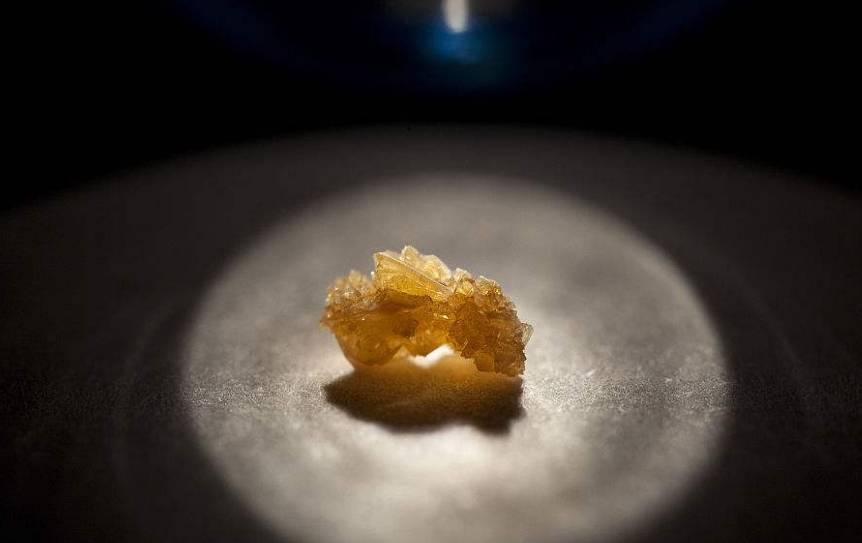 才会|肾结石突然疼是为什么?这几个症状说明肾结石严重化了