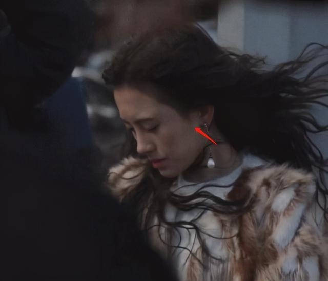 假发|她耳后斑秃？