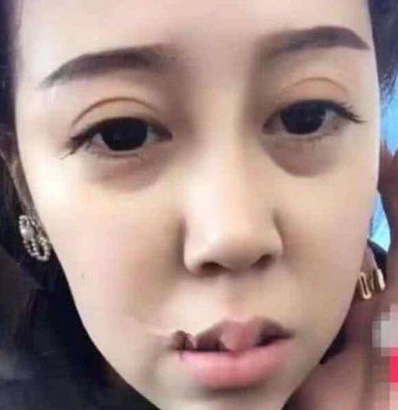 因为抖音小姐姐唇珠奇大，想到了当年的嘟嘟姐，网友：好想薅下来！