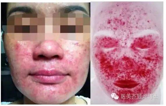 治疗齐显龙博士：敏感皮肤治疗和护理指南
