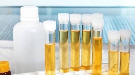 女士|紫癜肾炎患者病情“急转直下”，只因滥用激素药物！