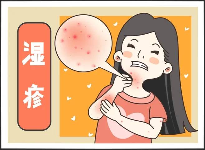 湿疹不会无缘无故出现,过敏性湿疹护理的5个要点,值得收藏_患者