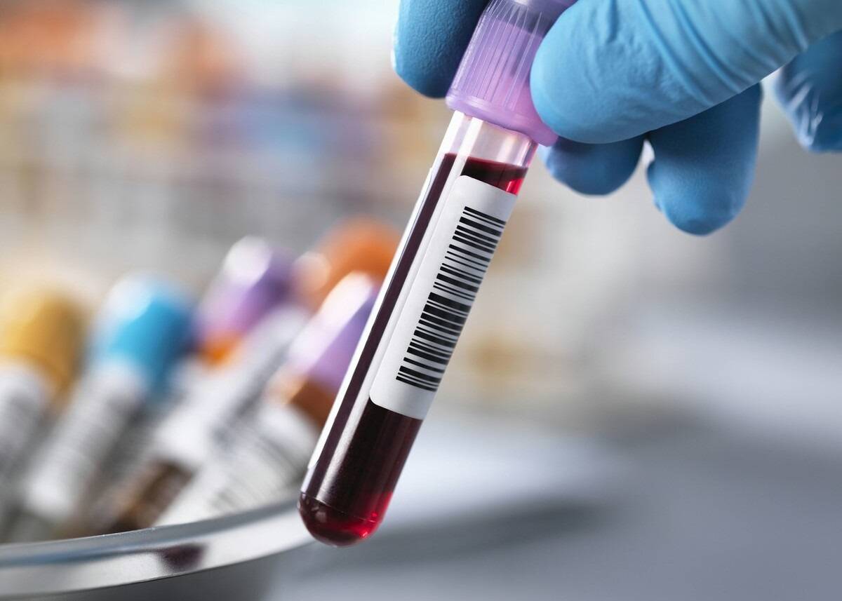 他汀|长期吃他汀，把肝吃伤了、肌肉溶解了，谁能负责？