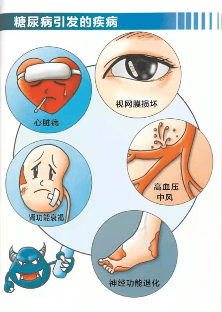 肾脏|关注糖尿病肾病,早干预、早受益!