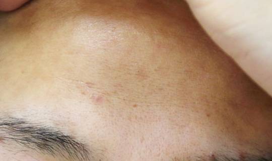 眼睛|肝病“找上门”时，身体可能出现这4种情况，别忽视，及时就医