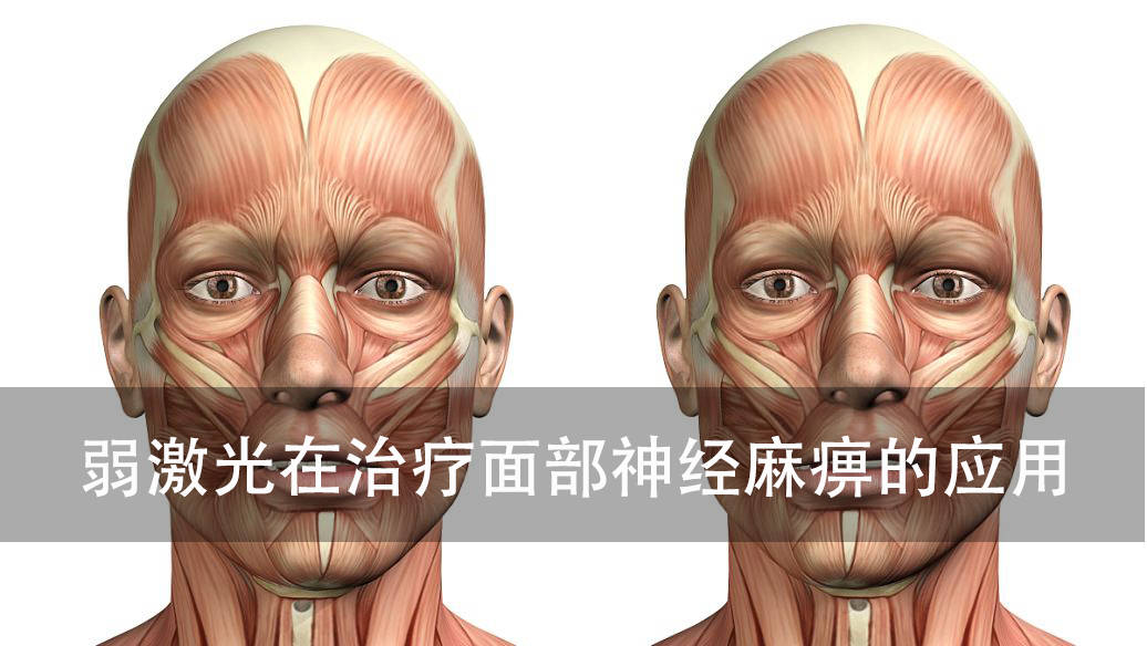 神奇弱激光在治療面部神經麻痺的應用