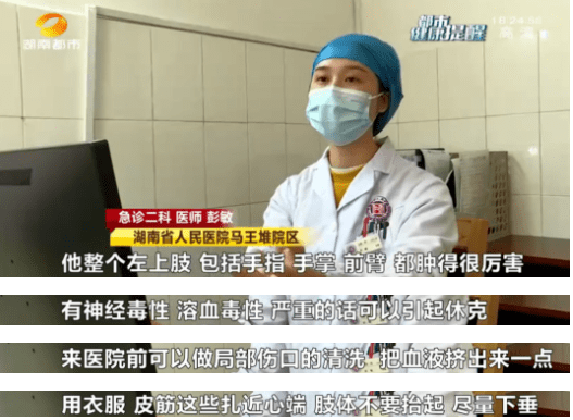 長沙|男子被魚刺扎一下緊急送醫！醫生：?這種魚刺毒性極強！6根可致死