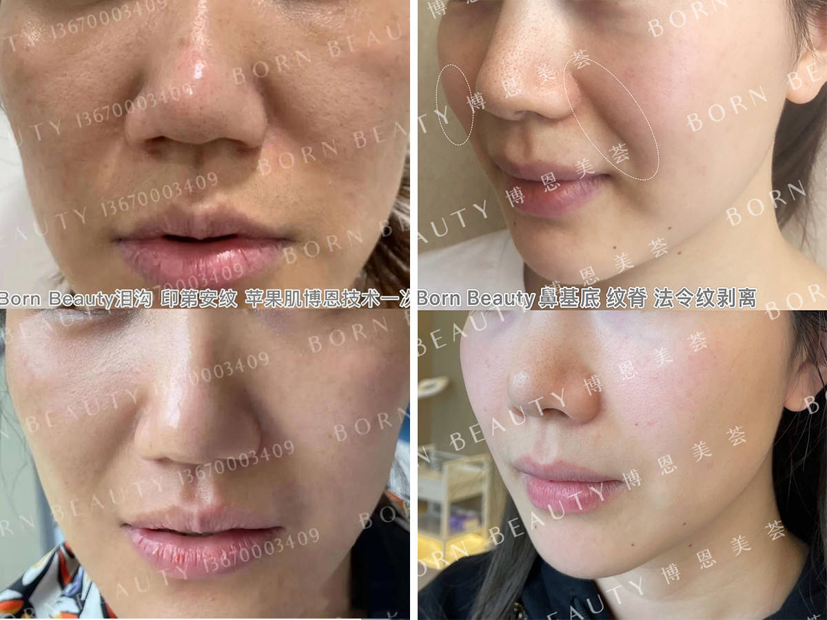 苹果逢亮相必热搜，唐嫣状态满分的秘密武器原来靠的是它！