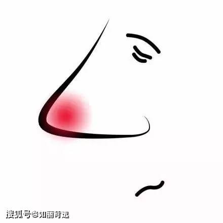 地基100个鼻基底塌陷的人，99个都想做3D打印鼻基底