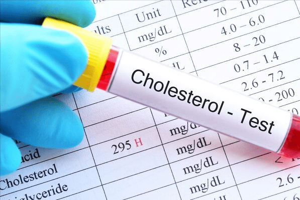 模型|吃花生到底是能诱发中风发作，还是能帮助预防中风？看专家怎么说