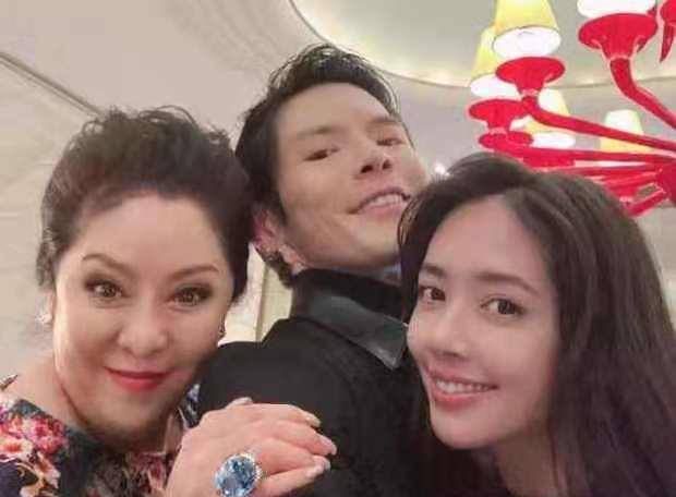 颧骨 郭碧婷近照曝光！产后瘦到颧骨凸起显疲惫，向太沉迷美颜变锥子脸