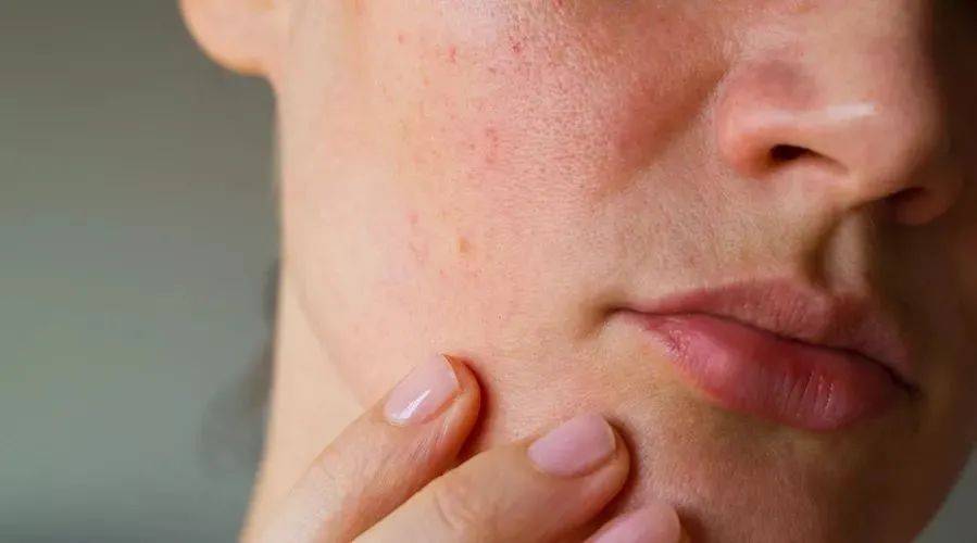 症状不做轻医美很惨,做了轻医美更惨?