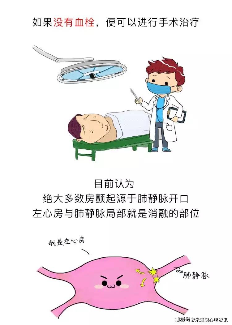 房颤|你了解房颤吗?一文图解掌握