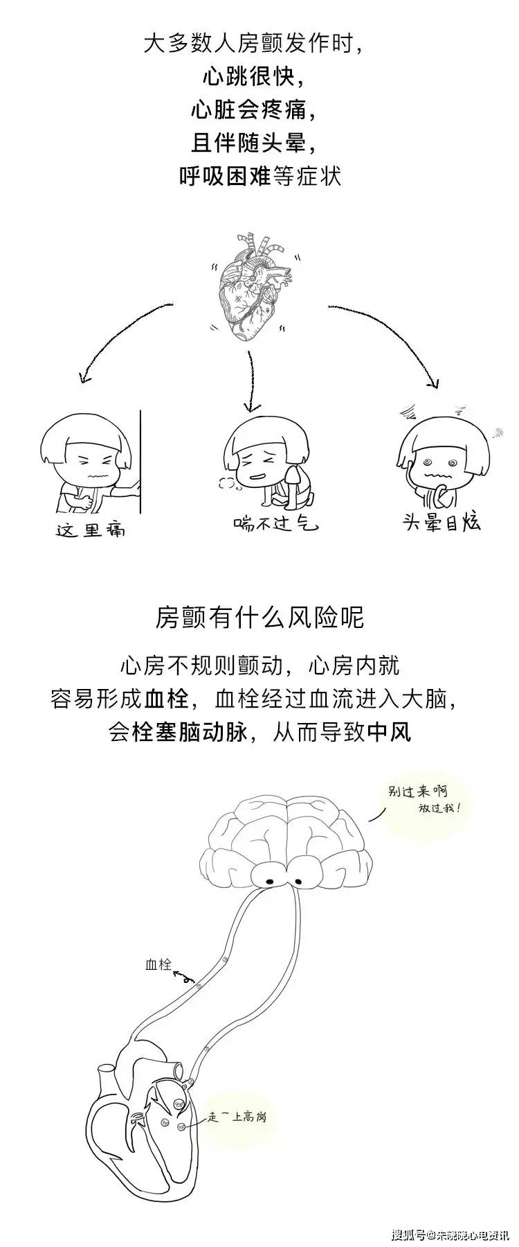 房颤|你了解房颤吗?一文图解掌握