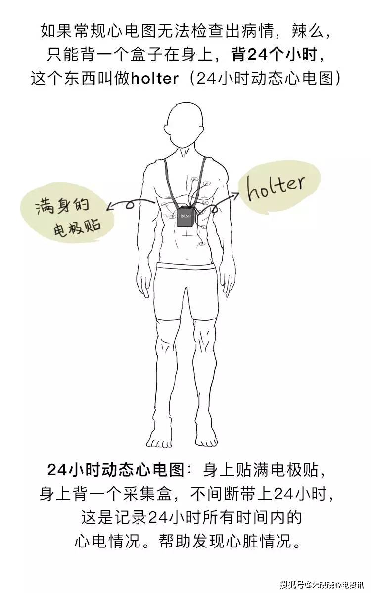 房颤|你了解房颤吗?一文图解掌握