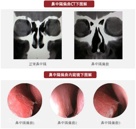 鼻腔颜色正常图片图片