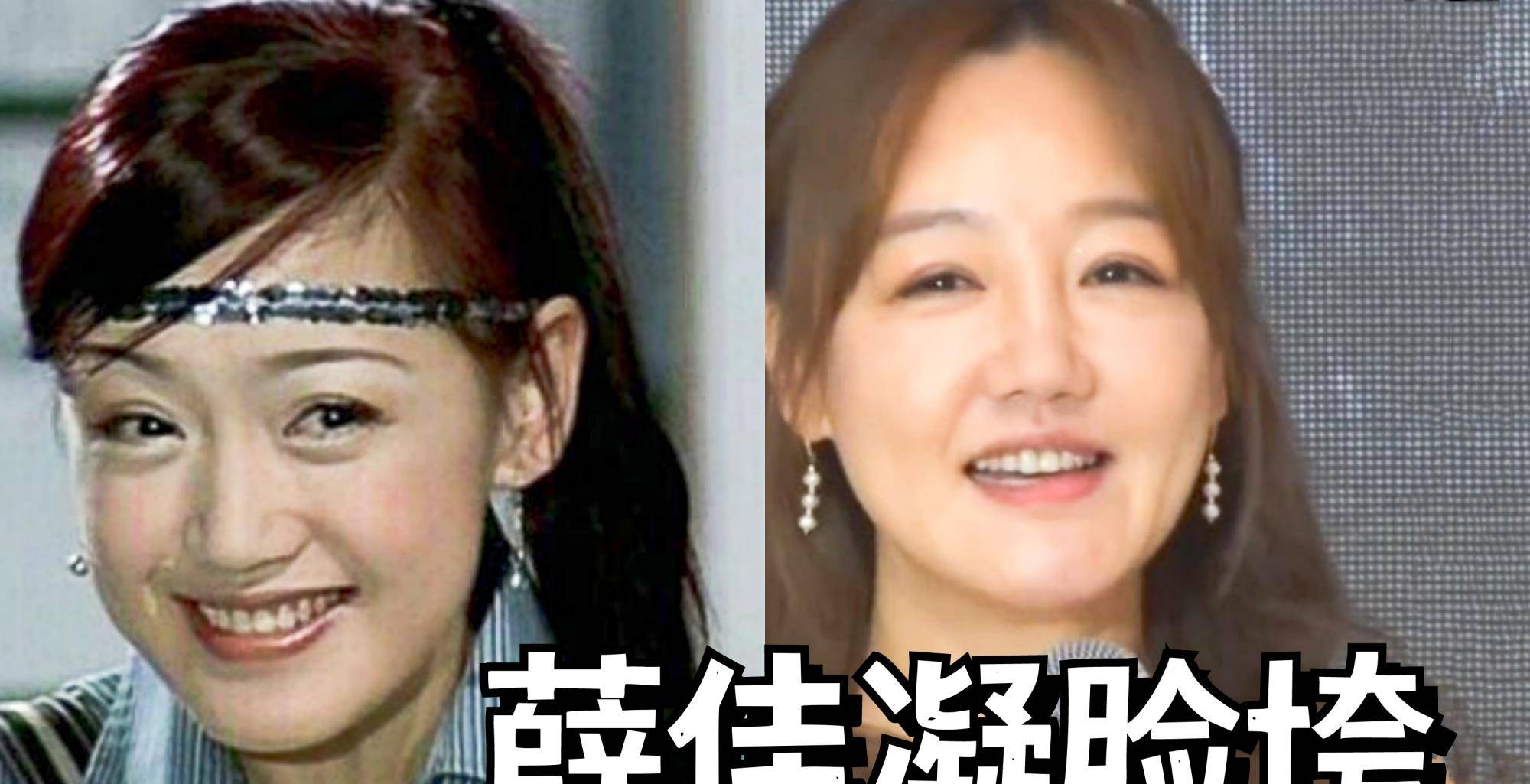 薛佳凝的脸到底怎么了 胡歌 苹果 女郎 全网搜 薛佳凝的脸到底怎么了 胡歌 苹果 女郎 全网搜