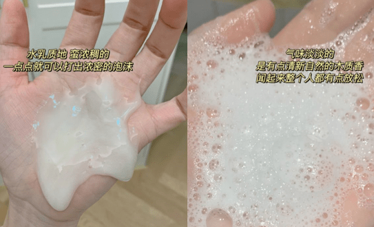 头皮洗发水越洗越秃？孕期别乱买网红洗发水，资源头皮痒，植观不回购