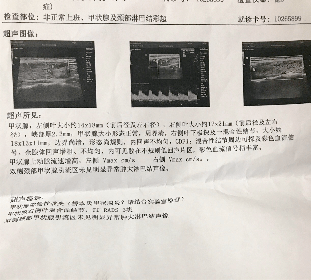 为啥那么多人的甲状腺结节,甲状腺炎治不好?