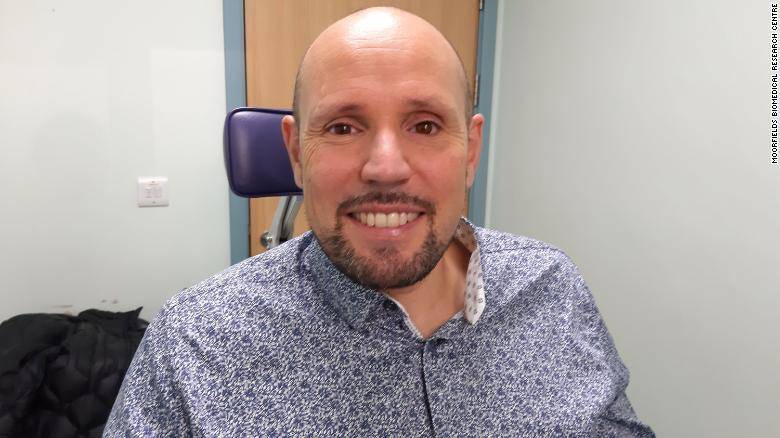 外媒：英国男子安装世界首个3D打印义眼，外形更逼真