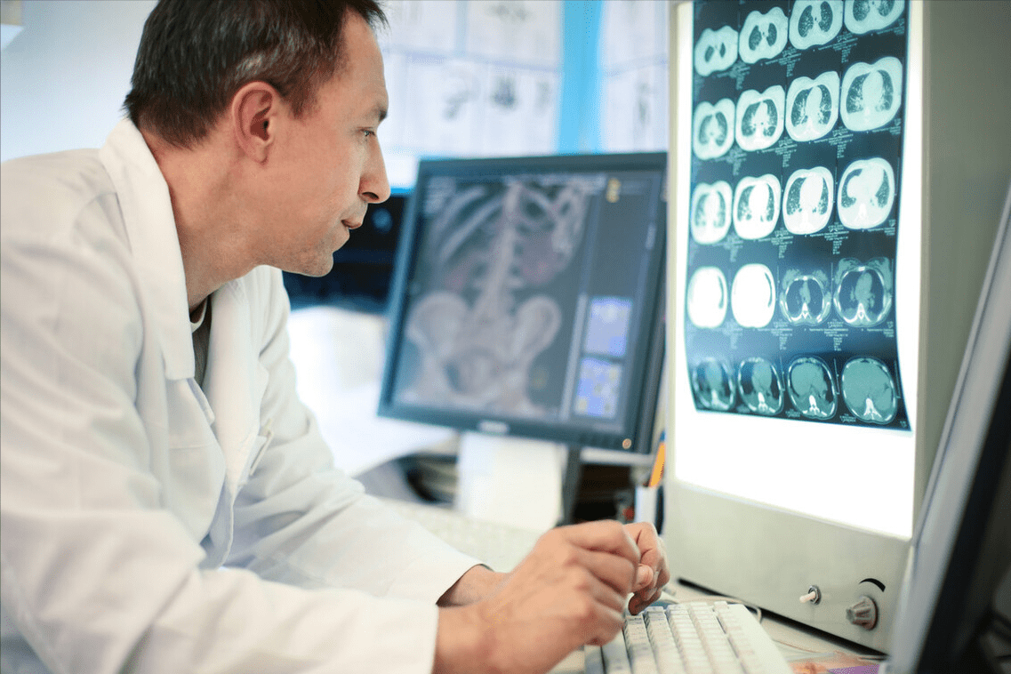 扫描|为啥医生都给脑梗患者先做CT，而不是磁共振检查？医生告诉您实情