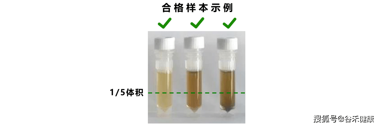 肠道|肠道菌群健康检测报告——常见问题解析