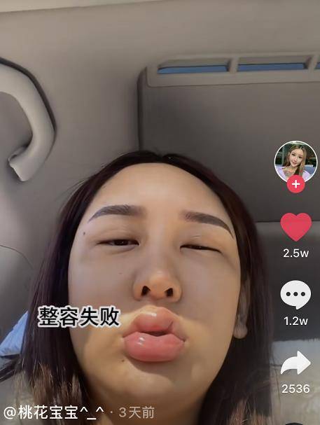 因为女网红沉迷整容却越整越难看，近照嘴巴肿成香肠嘴，承认整容失败