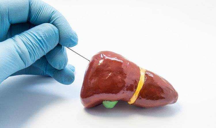 进行|5种症状不断出现，很大可能是肝硬化要来了，须及时检查