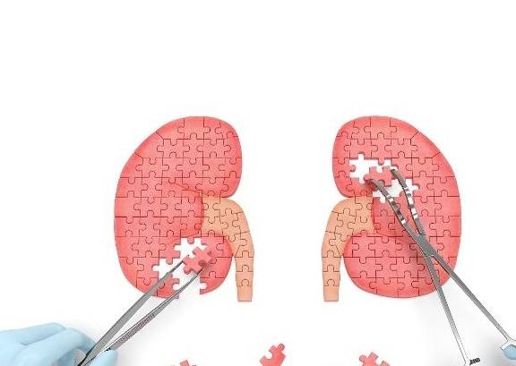 肾脏|医生:3大伤肾行为尽量少做,可能是尿毒症“加速剂”,肾友须知