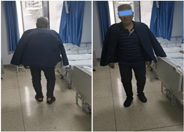 西安市红会医院神经内科治疗两例帕金森病冻结步态 效果显著