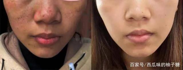 白得更美白淡斑护肤品哪款好？用这个精准亮白淡斑，美到发光！