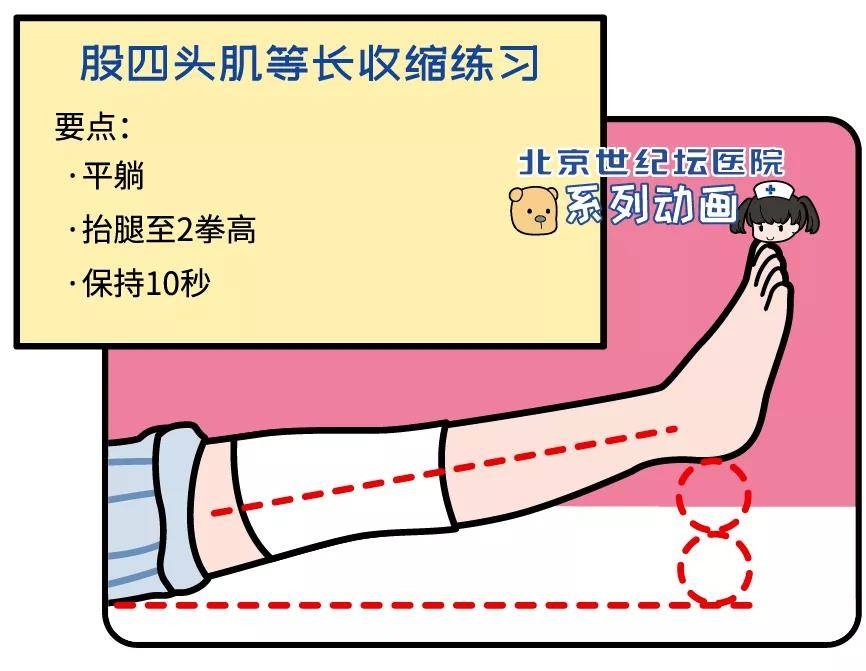 科普動畫圖文版韌帶受傷了