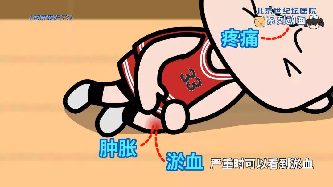 运动_锻炼_关节