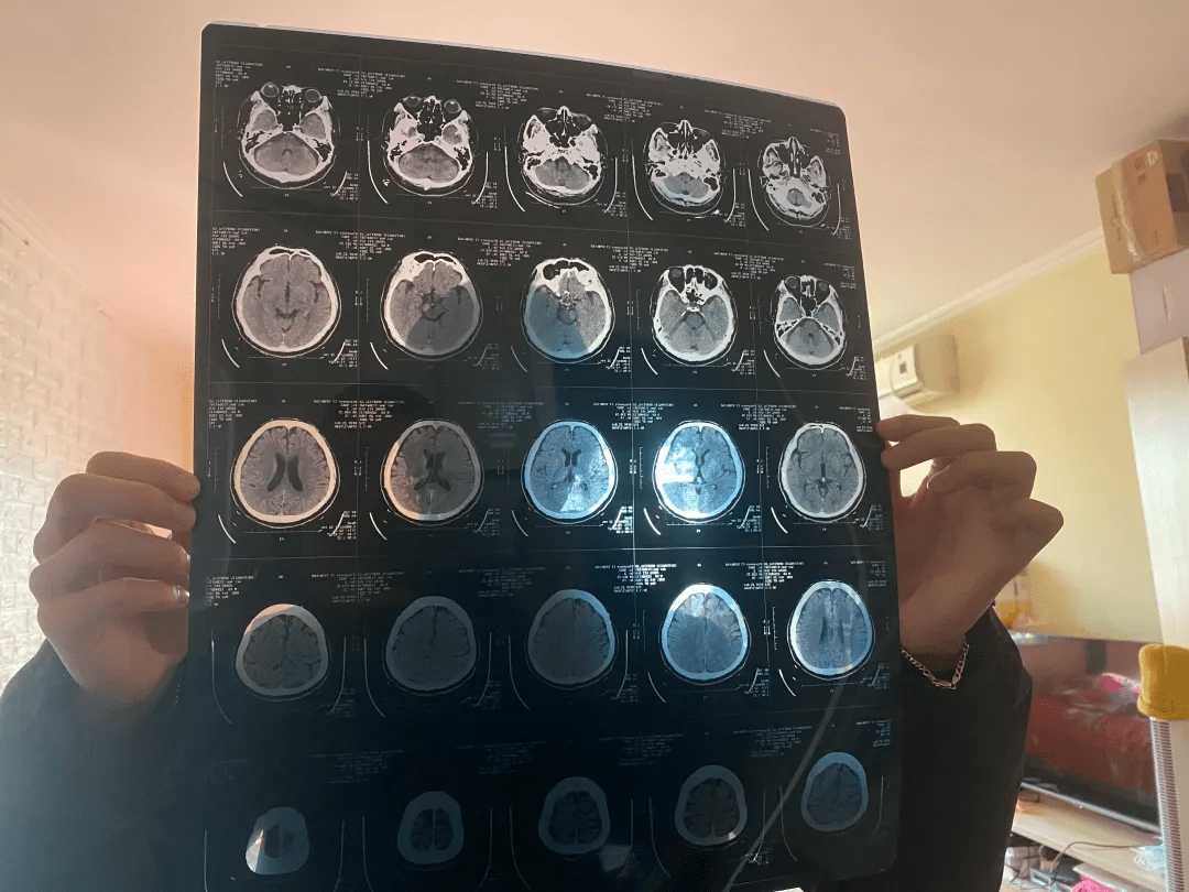 苏科|广场“舞王”苏科猝死,这类人群就不要剧烈跳舞了!