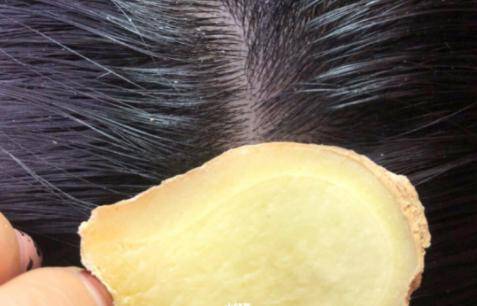 目前市面上所流传的生姜擦头皮生发的理论是:希望利用生姜的主要成分