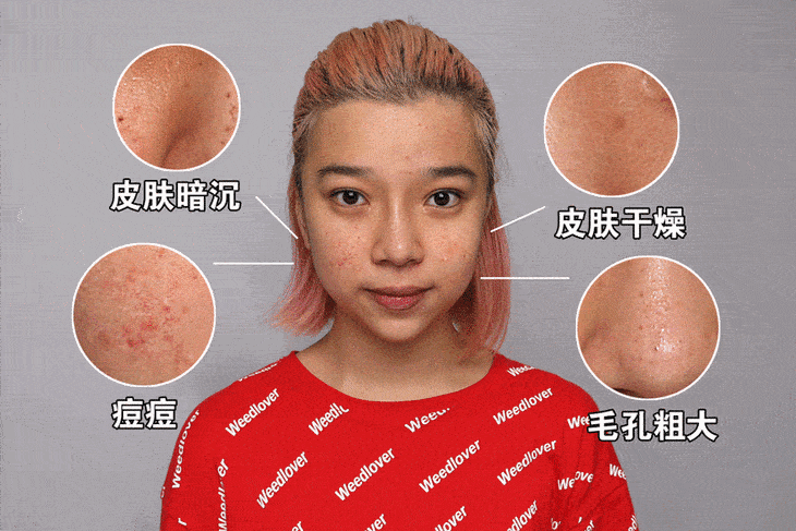 睡眠|不论男女，发现脸上有4种变化，小心肝已“变硬”，及时做检查