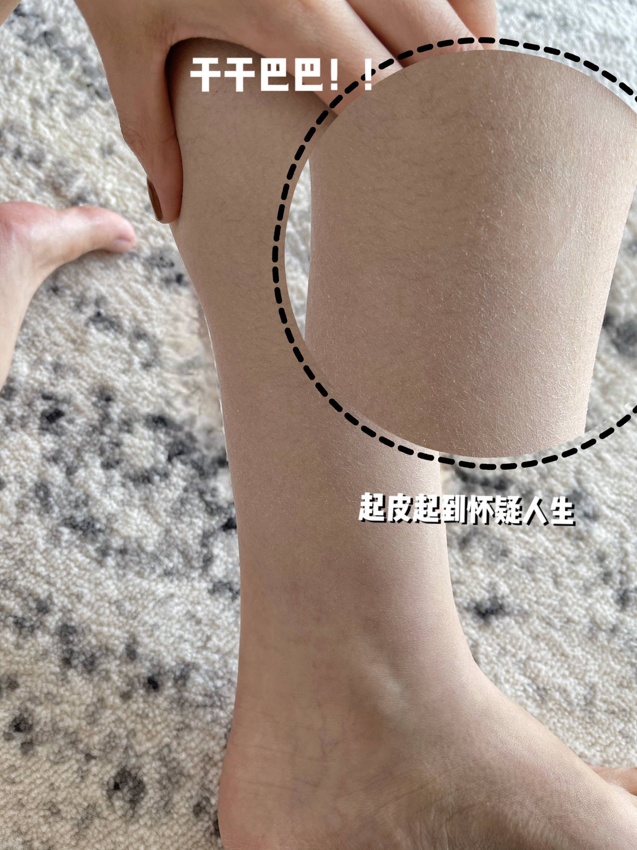 冬天腿痒抹身体乳有用吗(冬天腿痒抹身体乳有用吗女) 冬天腿痒抹身体乳有用吗(冬天腿痒抹身体乳有用吗女)