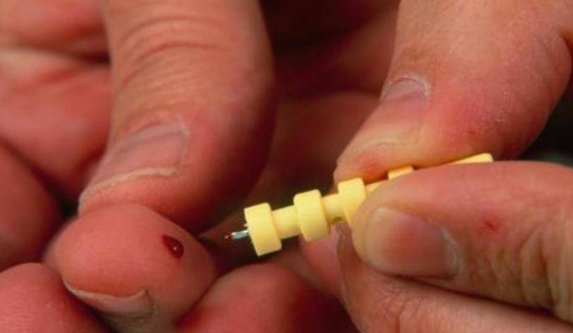 空腹|测血糖扎哪根手指才准确?医生提醒:很多人扎错了,测了也是白搭