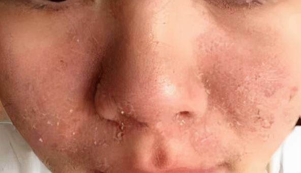 睡眠秋冬补水面膜冷冰冰？想不冷，看看它