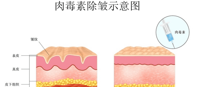 进行时间的魔法 | 除皱项目，面部年轻化