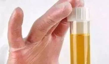 青色|肝脏不好的人,身体会出现6种表现,若没有,肝脏还算健康