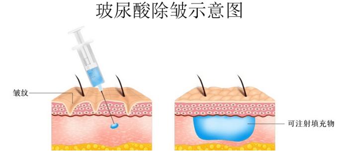 进行时间的魔法 | 除皱项目，面部年轻化